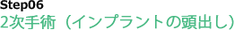 Step06 2次手術(インプラントの頭出し)